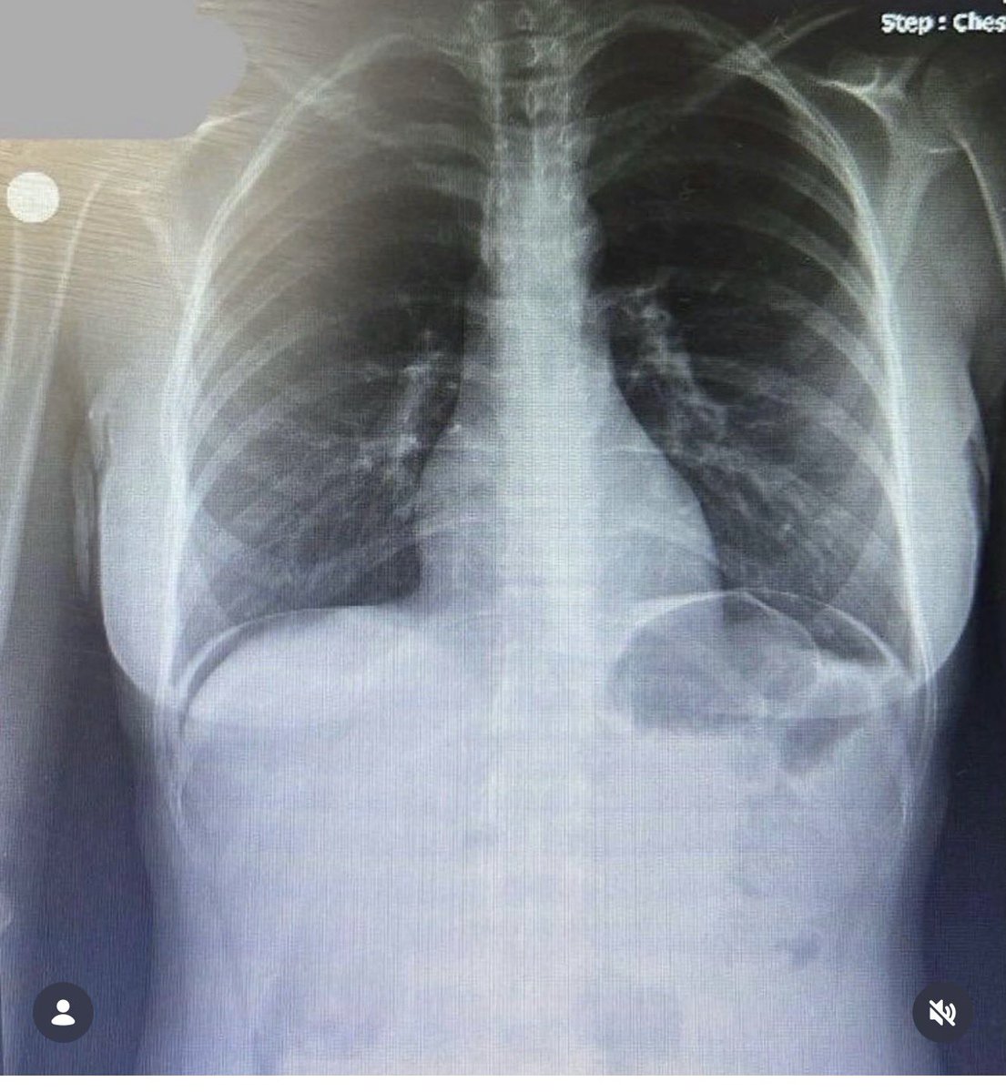 Uzm.Dr.Ayşegül İşlek Yüksel tweet media