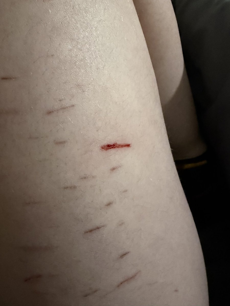 🧁 𝒥ames ogilvie of shtwt tweet media