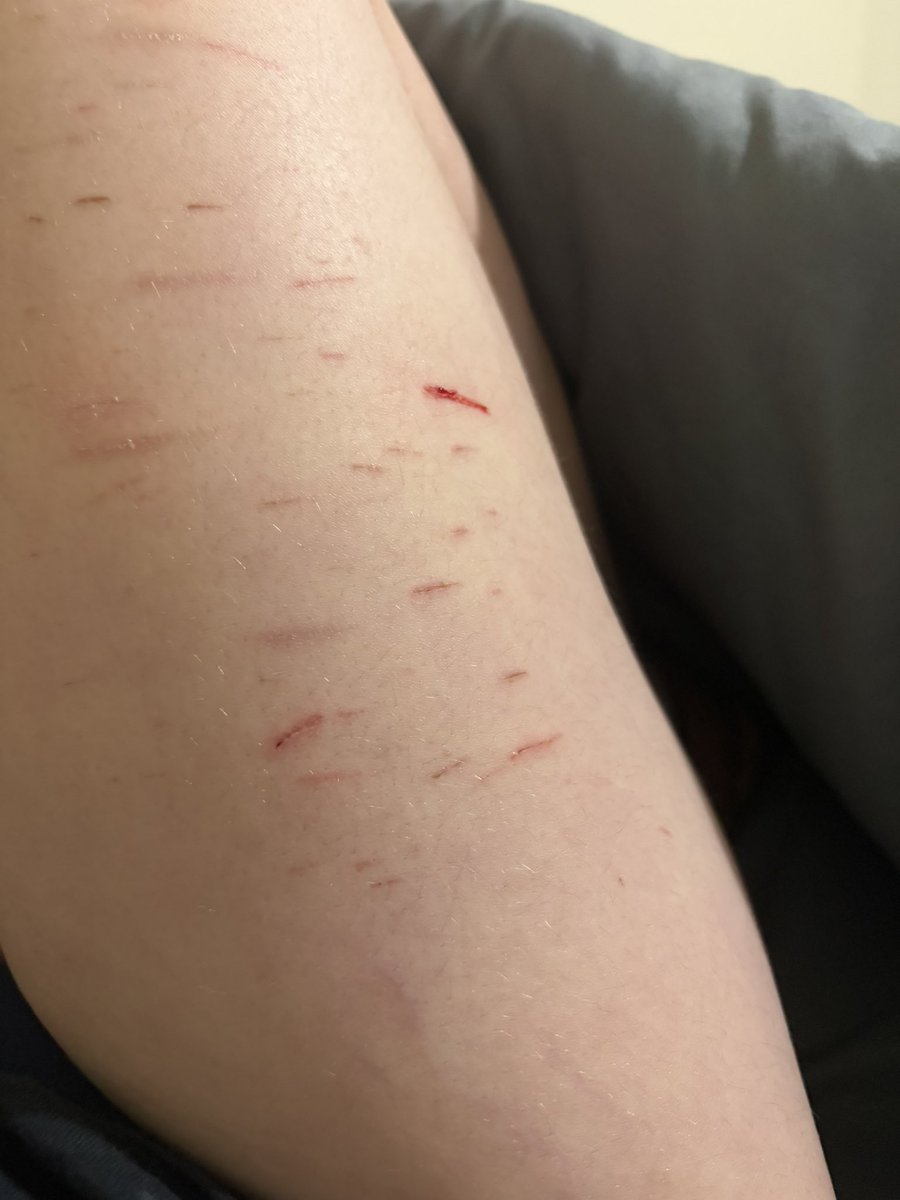 🧁 𝒥ames ogilvie of shtwt tweet media