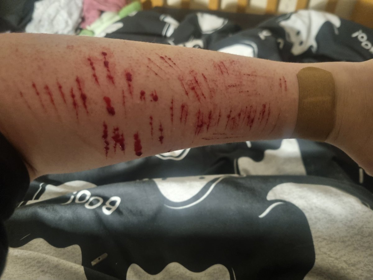 fnaffan_12's tweet photo. I'm getting too fucking lazy for cuts actually kill me I'm such a larper 💔#shtwt #slittwt #lazybastard https://t.co/6wAL7F7Uho