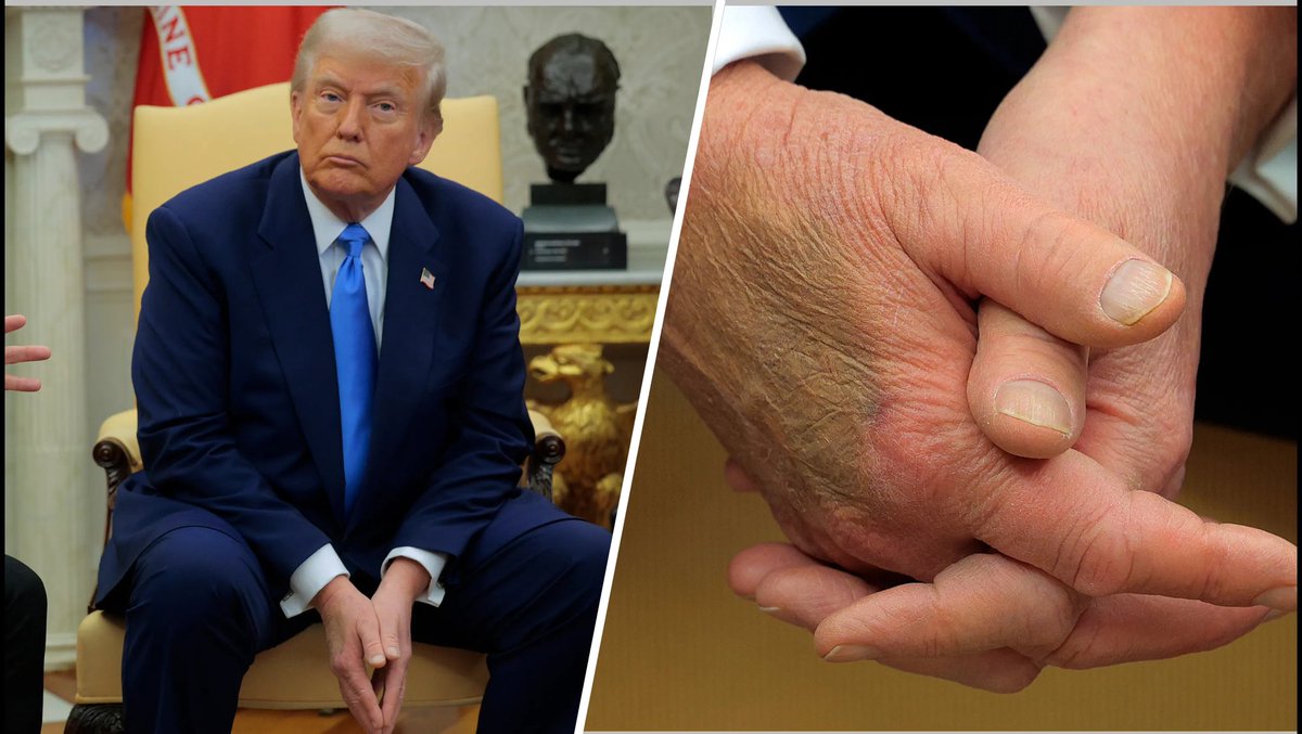 SantinoCripto® tweet media