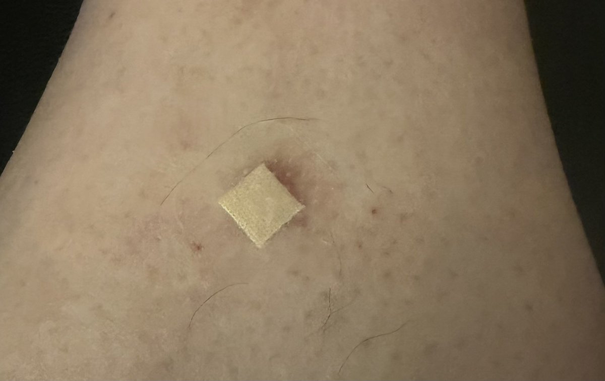 marcelolemos's tweet photo. Comprei um band-aid que dizia ser transparente. A expectativa X realidade 😒 https://t.co/r4JN7rM4C8