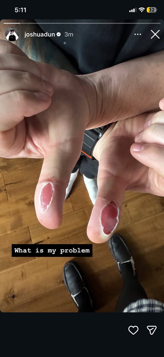 .tyler ✮⋆˙ shakyknees!! tweet media