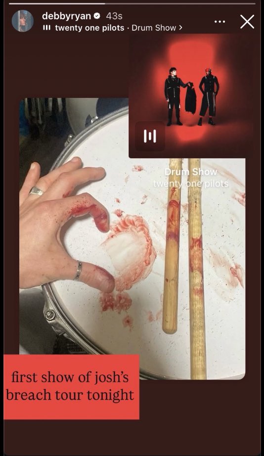 .tyler ✮⋆˙ shakyknees!! tweet media