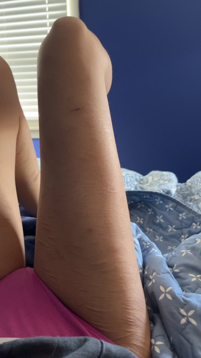 ☀️starrr ✧ (mydeimos of shedtwt) 🍷 tweet media