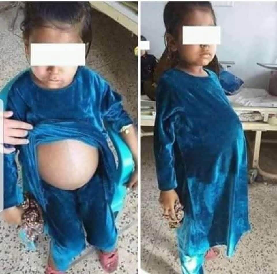 greasy weasel tweet media