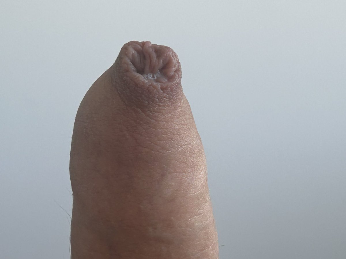outofbody4's tweet photo. Happy foreskin day! https://t.co/7Ym8rWlxO0