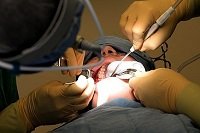 🇨🇺 El 4 de abril de  1986- Un equipo multidisciplinario del Hospital Hermanos Ameijeiras realiza la primera operación con microcirugía que se realiza en Cuba, en la especialidad maxilofacial. #CubaViveEnSuHistoria #MatancerosEnVitoria