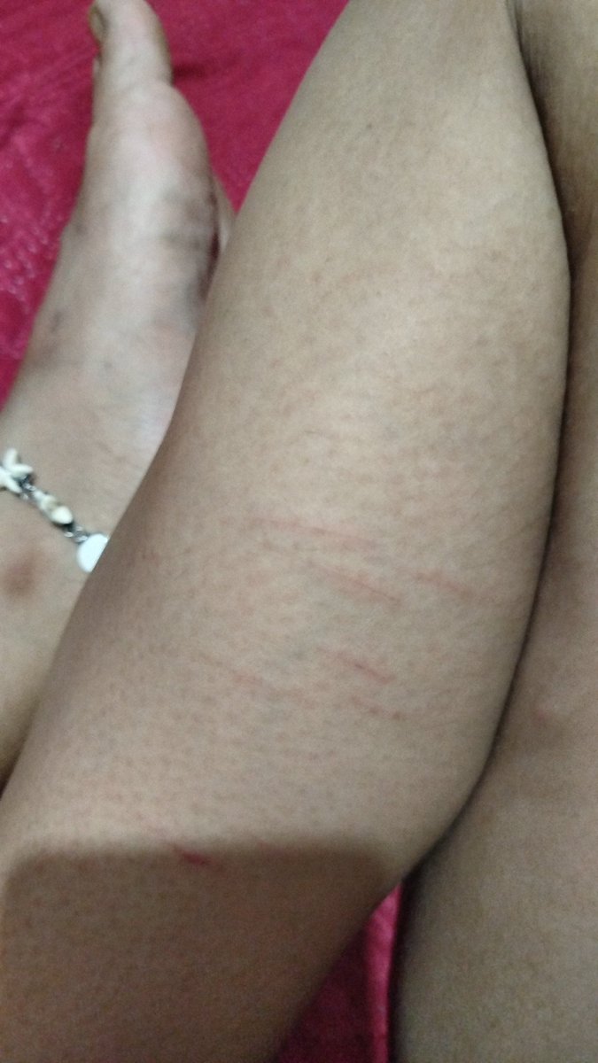 cash(-4/5) tweet media