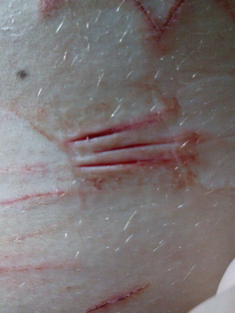 STAR of shedtwt tweet media