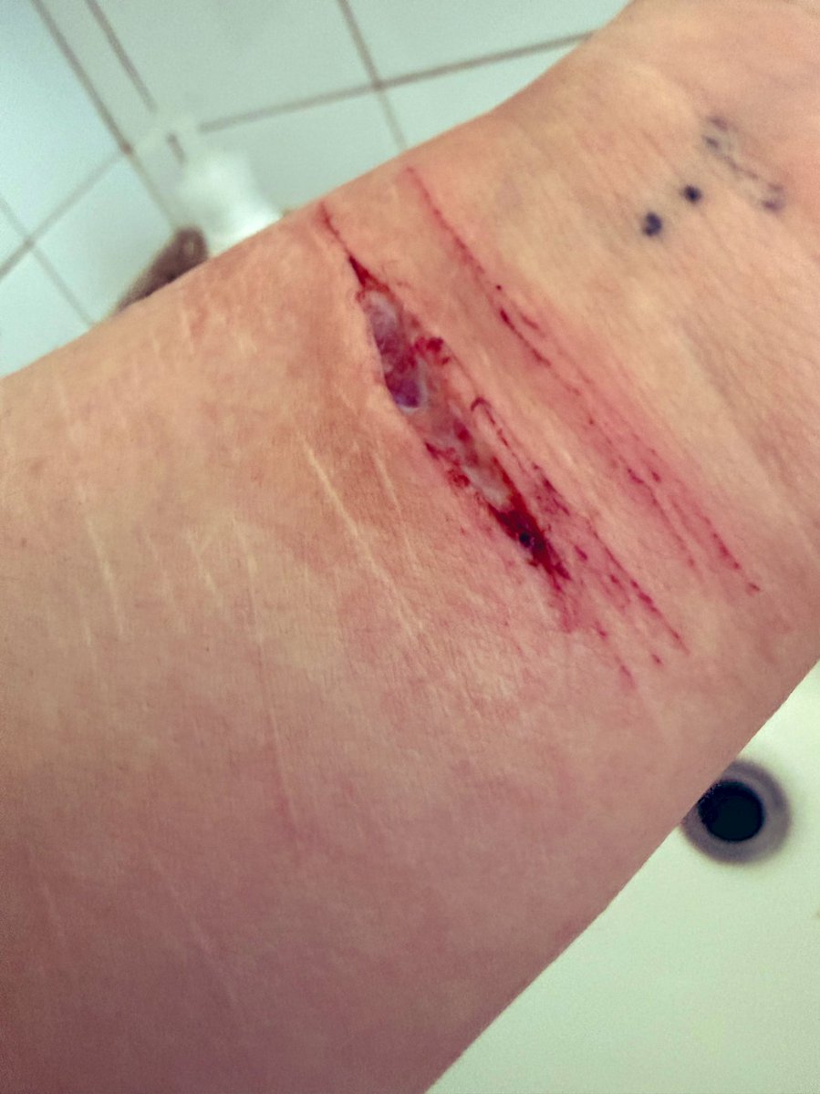 RyzenZX2008's tweet photo. The next day from my sesh from last night I think like 5-6 swipes with a dull ass blade hurts like a bitch (lowkey don’t know is this beans or styro I can’t tell lmao #shtwt https://t.co/lMsypg2XkL