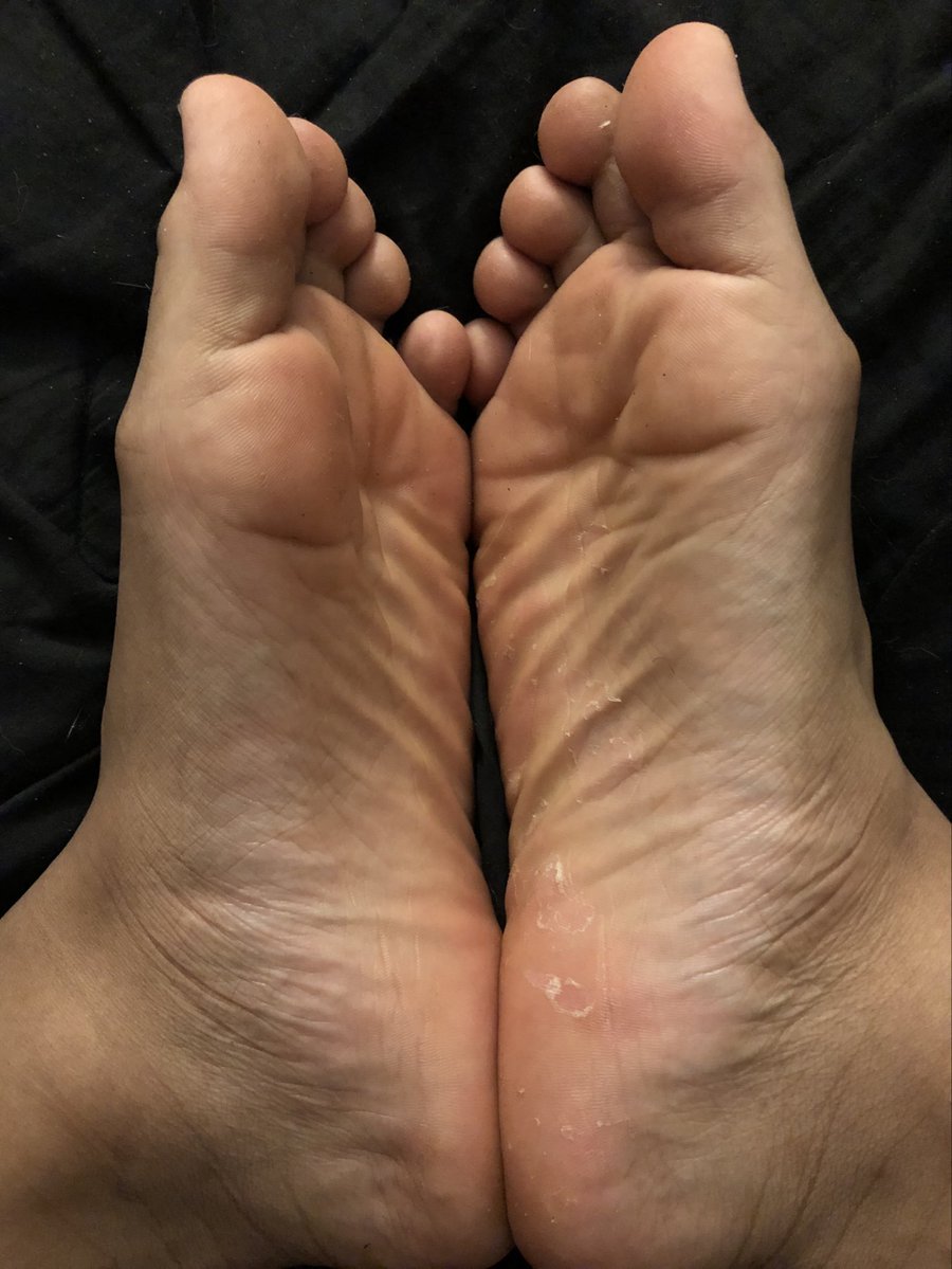 Kal-zone👻 tweet media