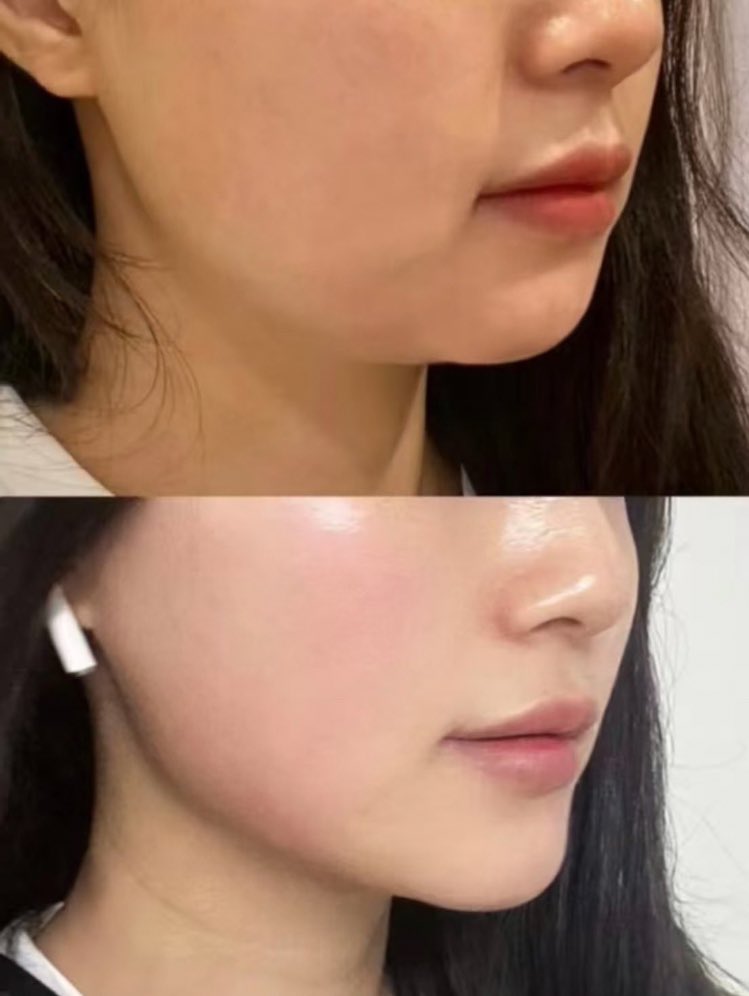 深夜にポテチちゃん tweet media