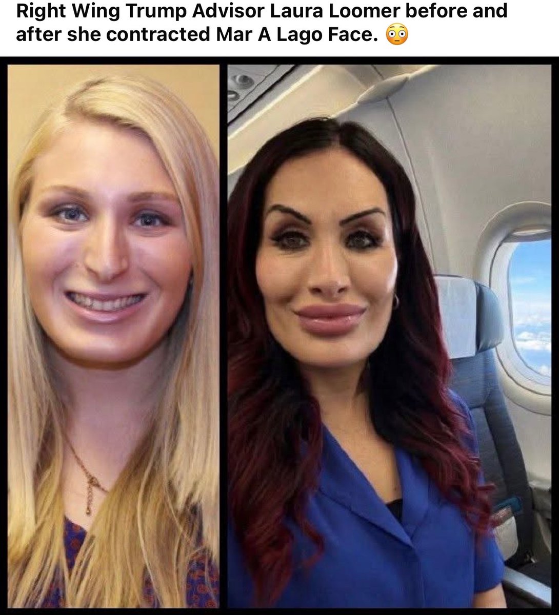 ruten bas tweet media