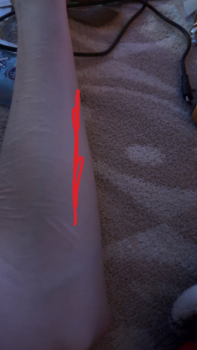 ~⚠️VXDO1⚠️~ tweet media