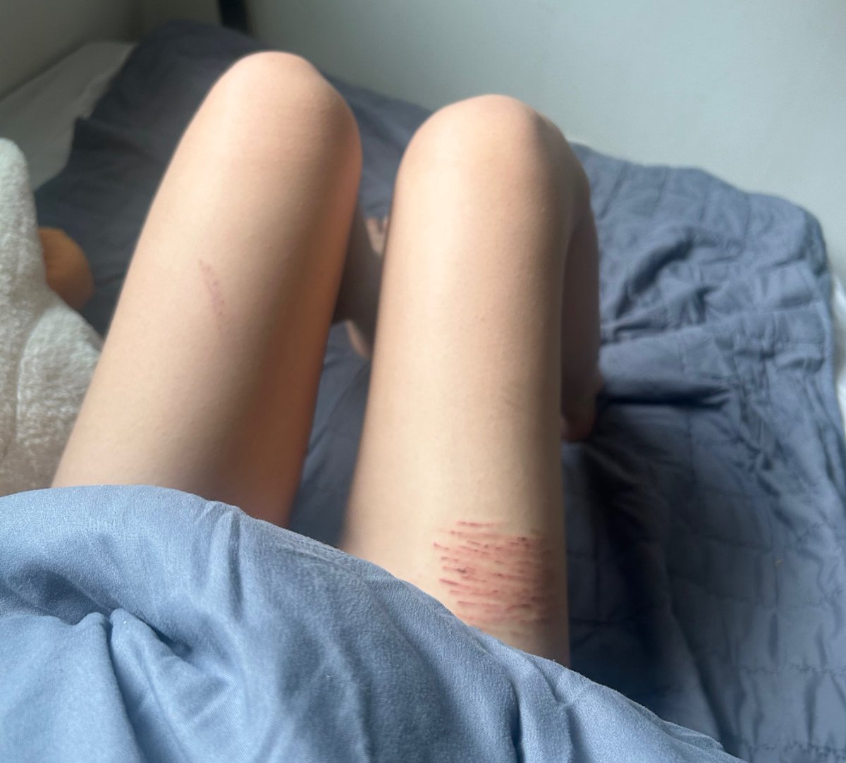 당 ㅌㅊㅅ tweet media