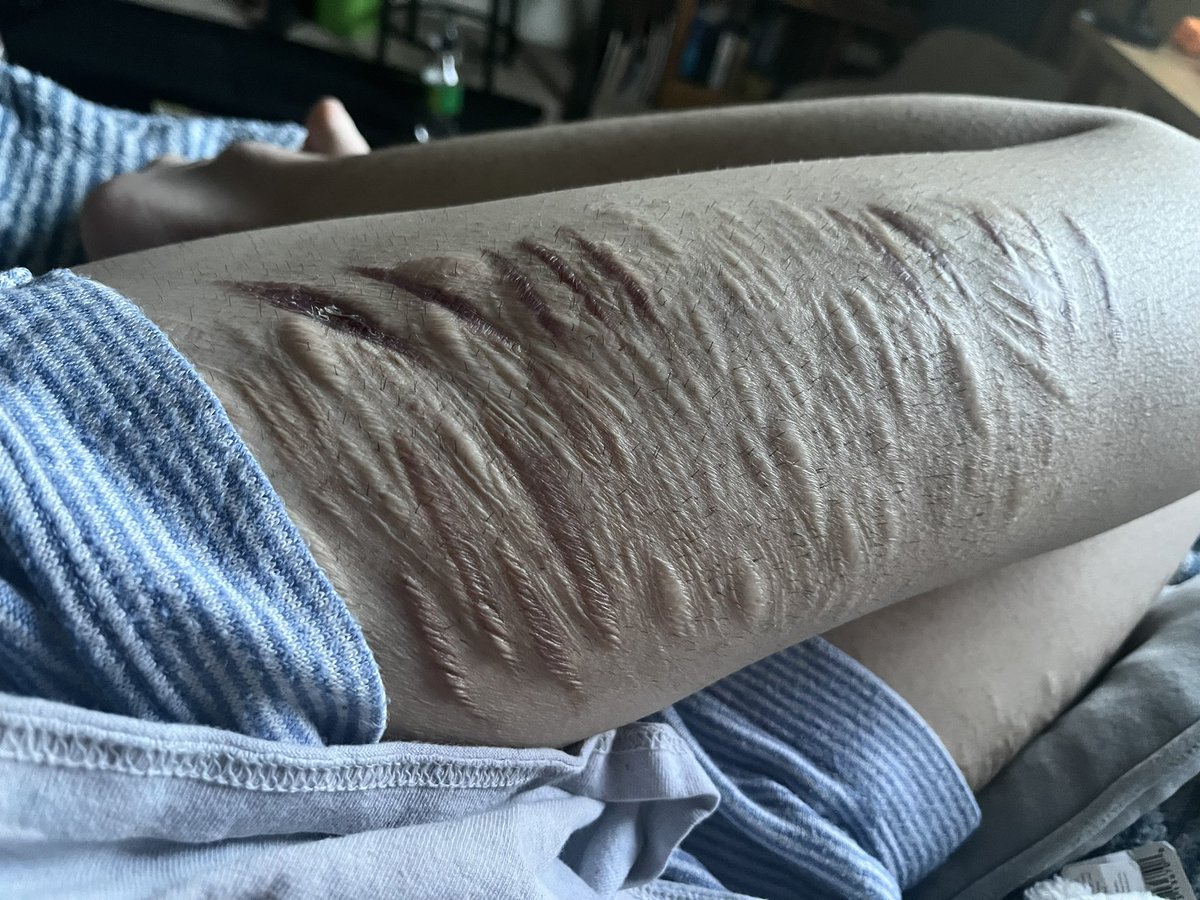 ca1wb 🍃 shedtwt tweet media