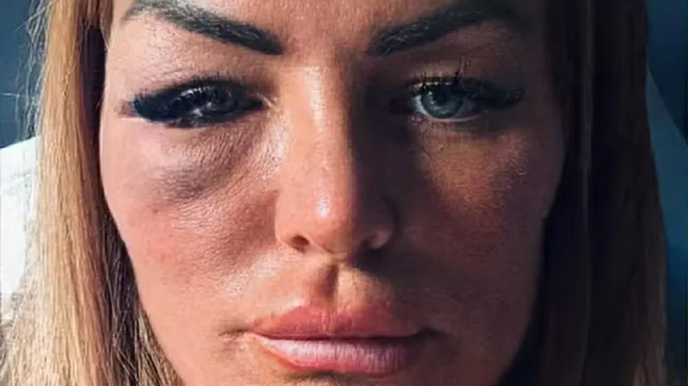 UpdateCharts tweet media