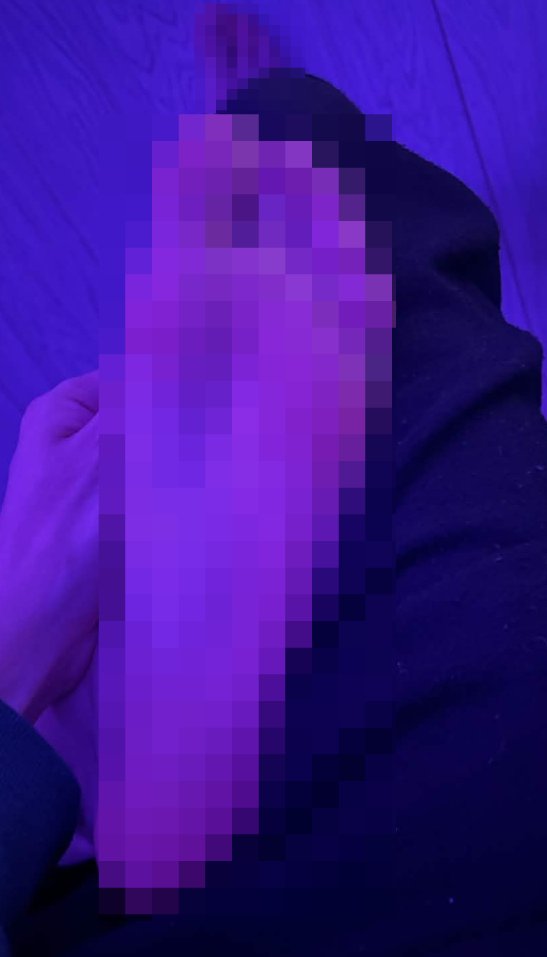 penis foid 🏳️⚧️ 🔞 tweet media