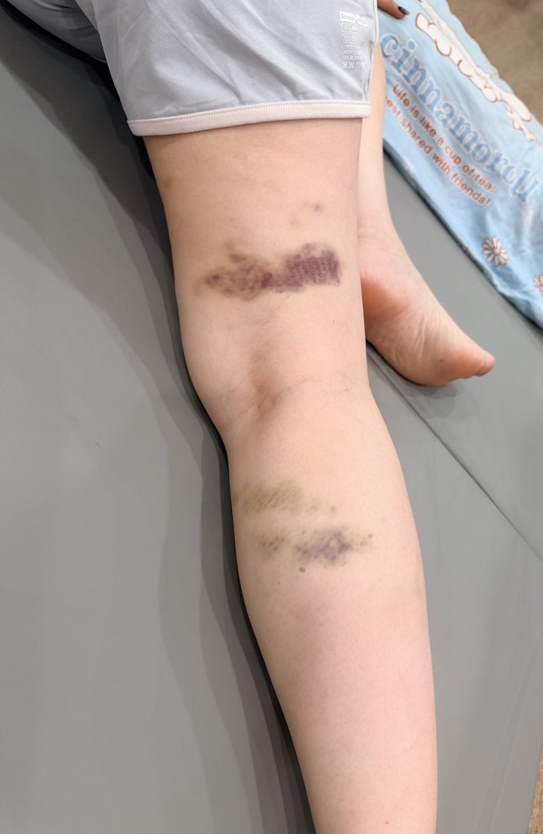 สิงโต🦁💚❤️🐰กาตุ่ย tweet media