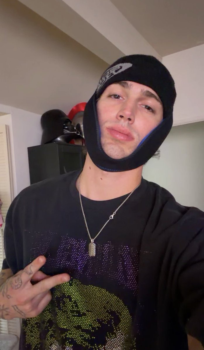 RemnantBorn's tweet photo. There goes my wisdom teeth https://t.co/WX3m1bf59E