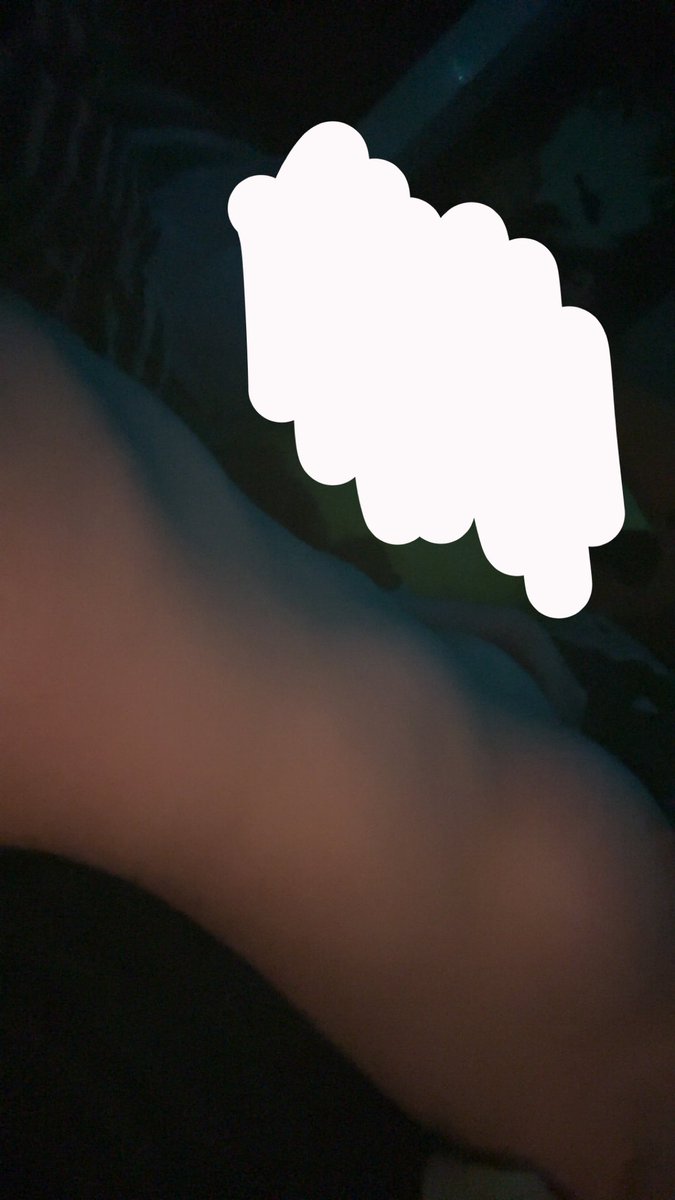 tuffboii0's tweet photo. Just need my ribs and hip bones sticking out then it’ll be alright #edtwt #nsfw #virallll https://t.co/vKdcb075vx