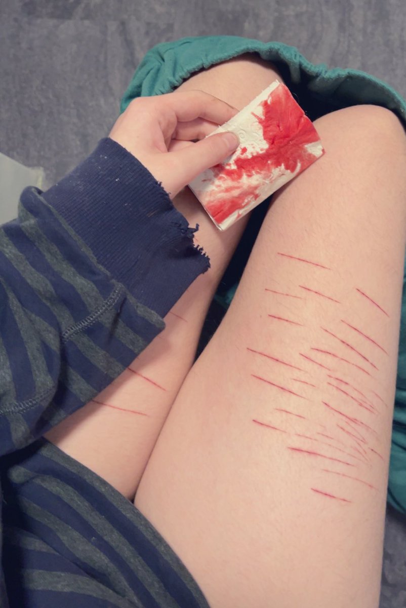 g0recake_rin's tweet photo. I wanna cut again and even deeper
#shtwt #edtwt #shedtwt #shed #sh #ed #slashflash #slashed #cutspo #cut https://t.co/Y1EoCsfvWZ