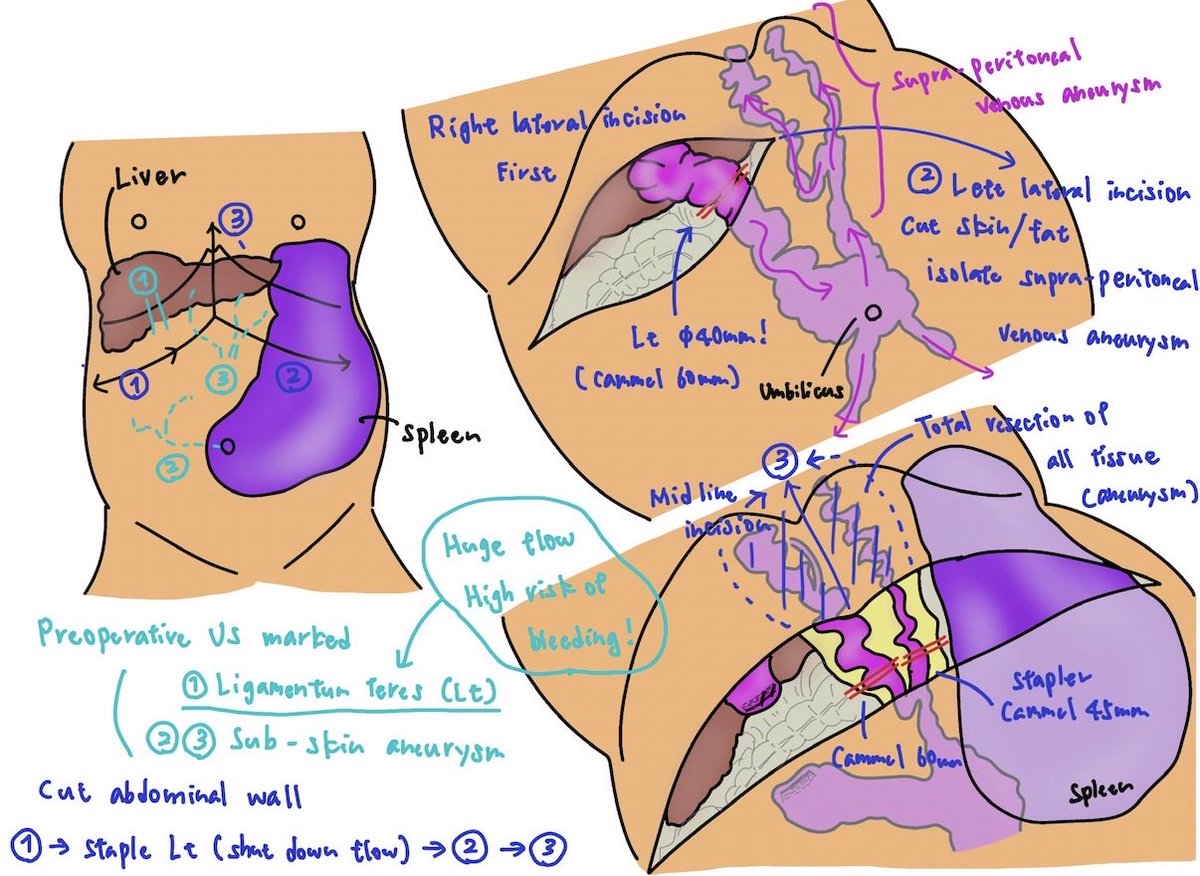 Toru Goto, MD tweet media