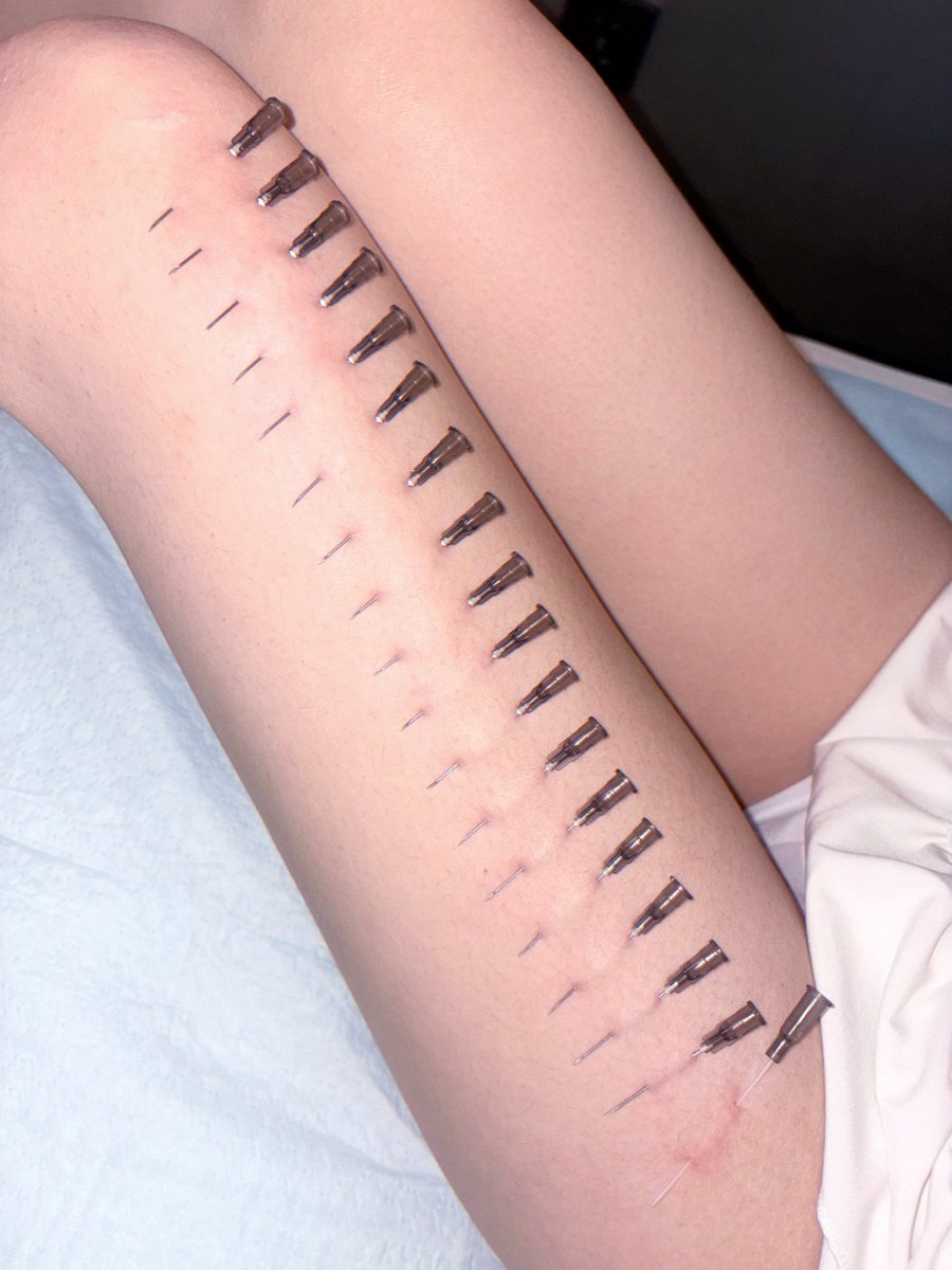 ▪️◽️樓◾️▫️ tweet media