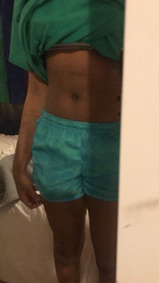 eww__emo's tweet photo. i was so thin, i can’t stand myself now #edtwt https://t.co/vnIs5wrqGG