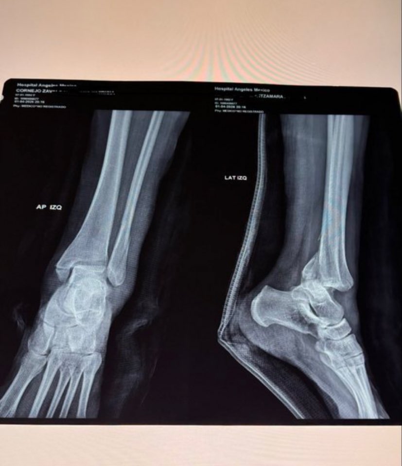 emilia_junkie 🤷🏻♀️👋🏻 tweet media