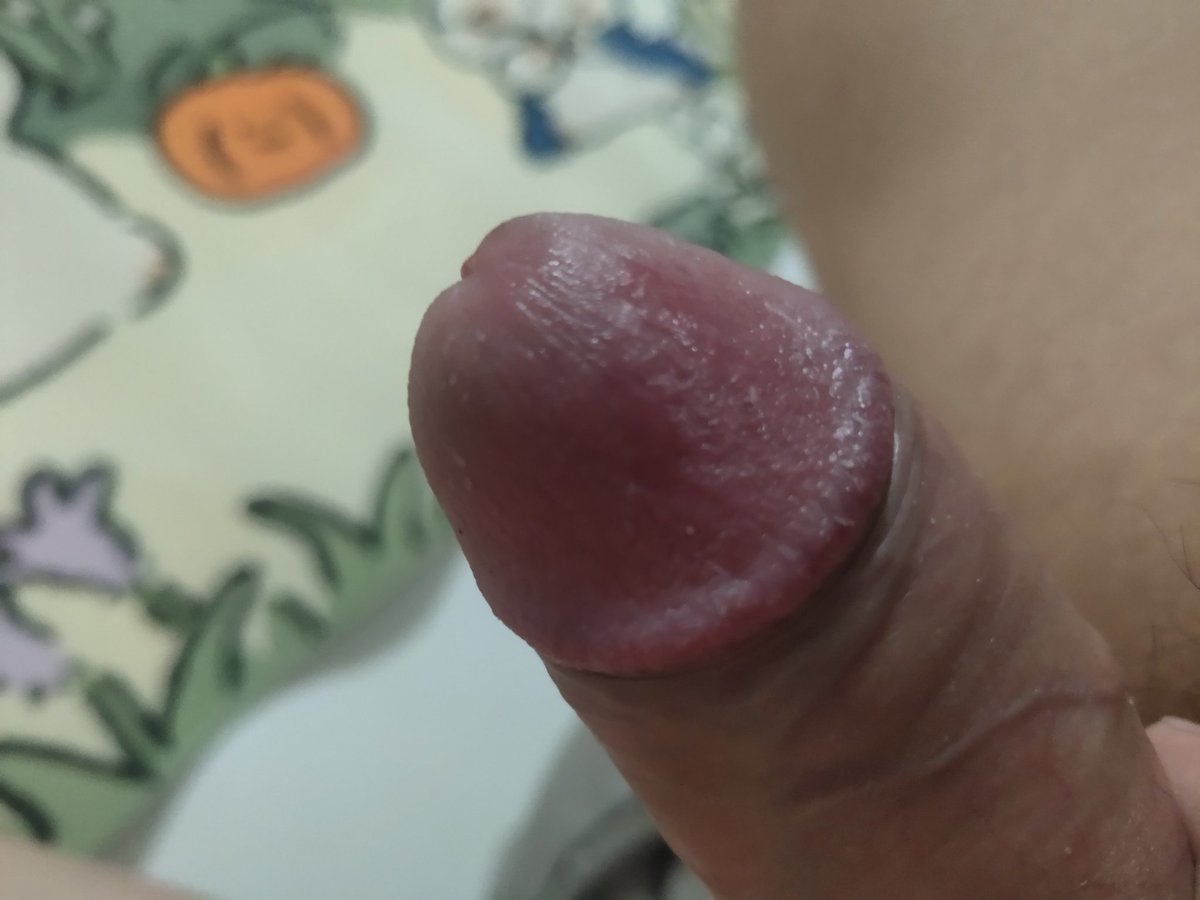 好臭的jb #原味 #臭屌 #包皮垢  #🧀