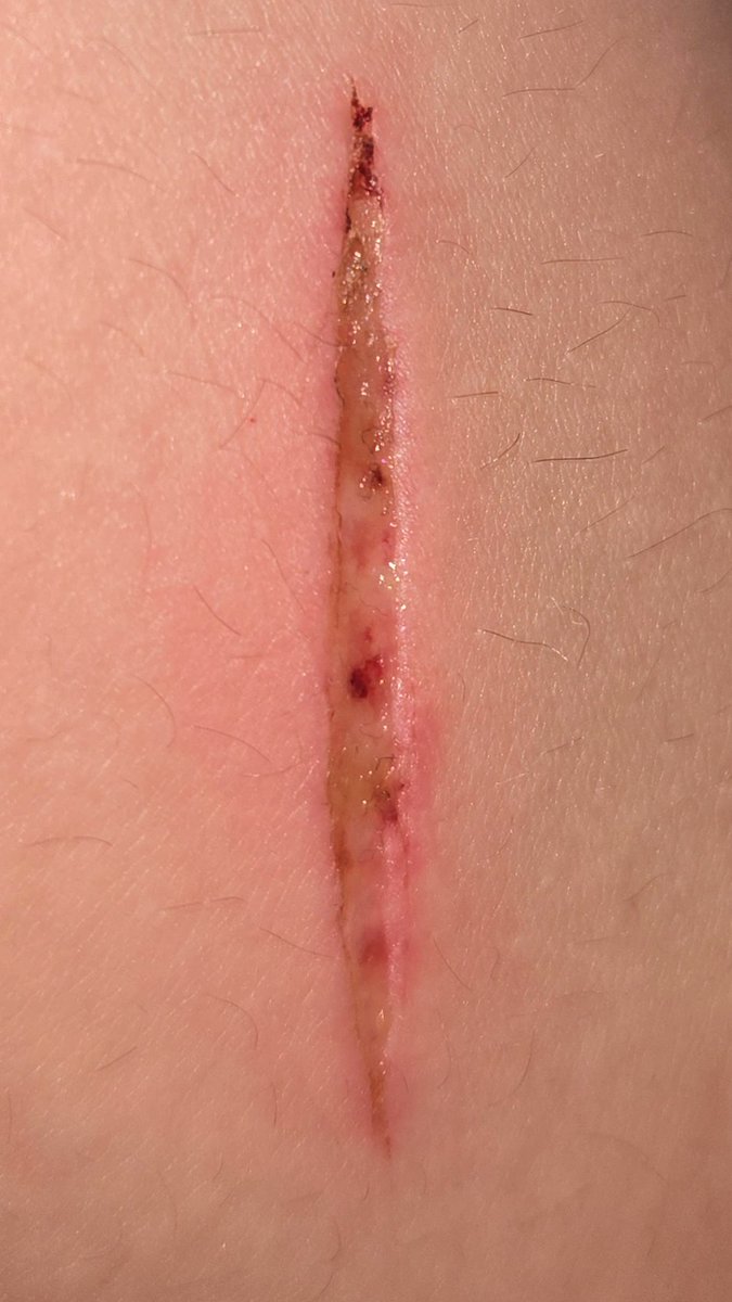 yuji of shedtwt tweet media