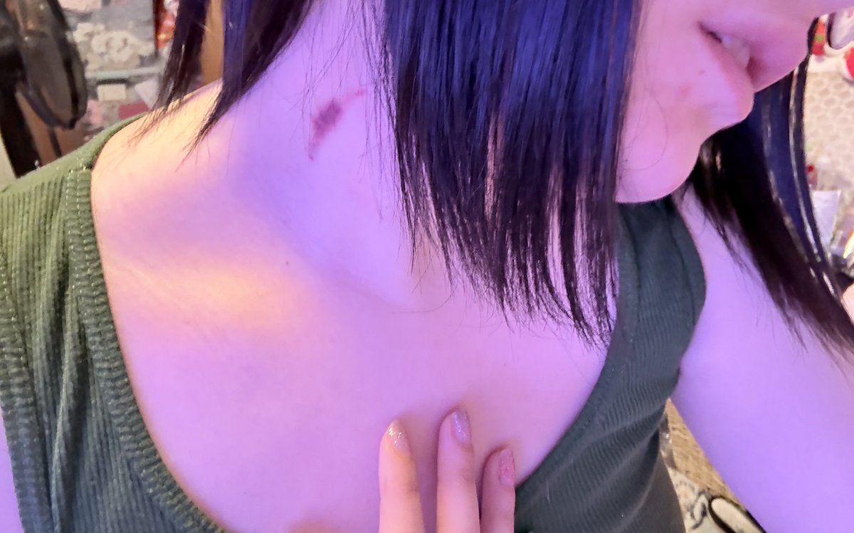 emmy ♡ tweet media