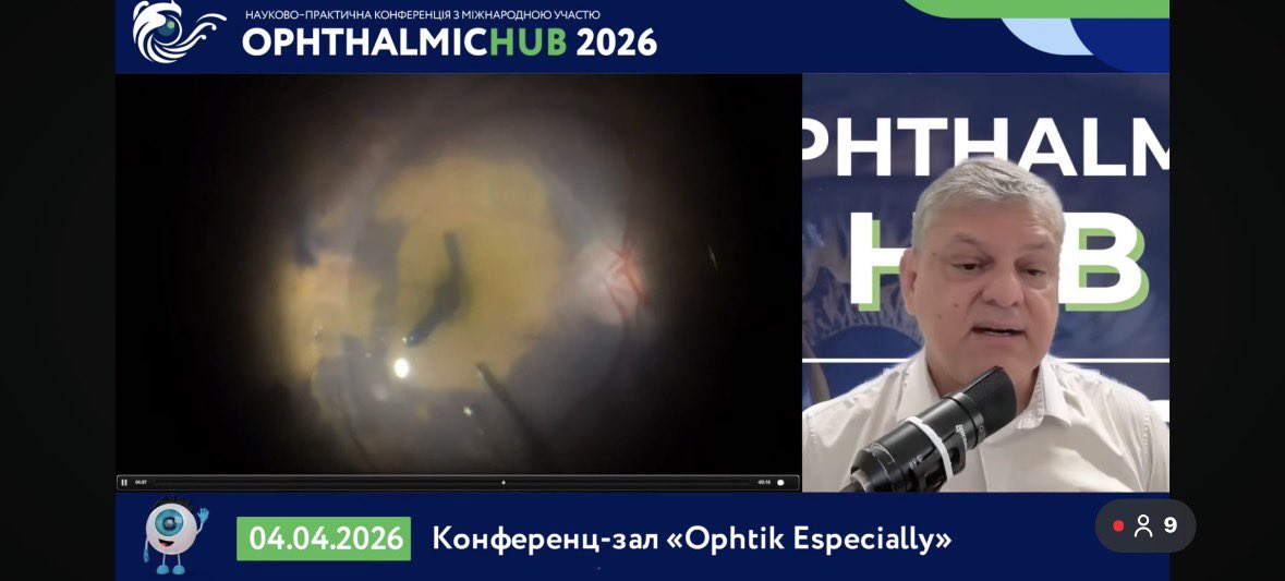 HUDSONNAKAMURA's tweet photo. 👁️ Game-Changing ILM SEAL Technique Drops at OphthalmicHub 2026! 👁️
Dr. Nakamura delivers a masterclass on tackling chronic large macular holes in phakic retinal detachment cases with the elegant ILM SEAL TECHNIQUE.
Watch how the ILM flap creates a powerful seal over the hole https://t.co/xhPVUDHgrK