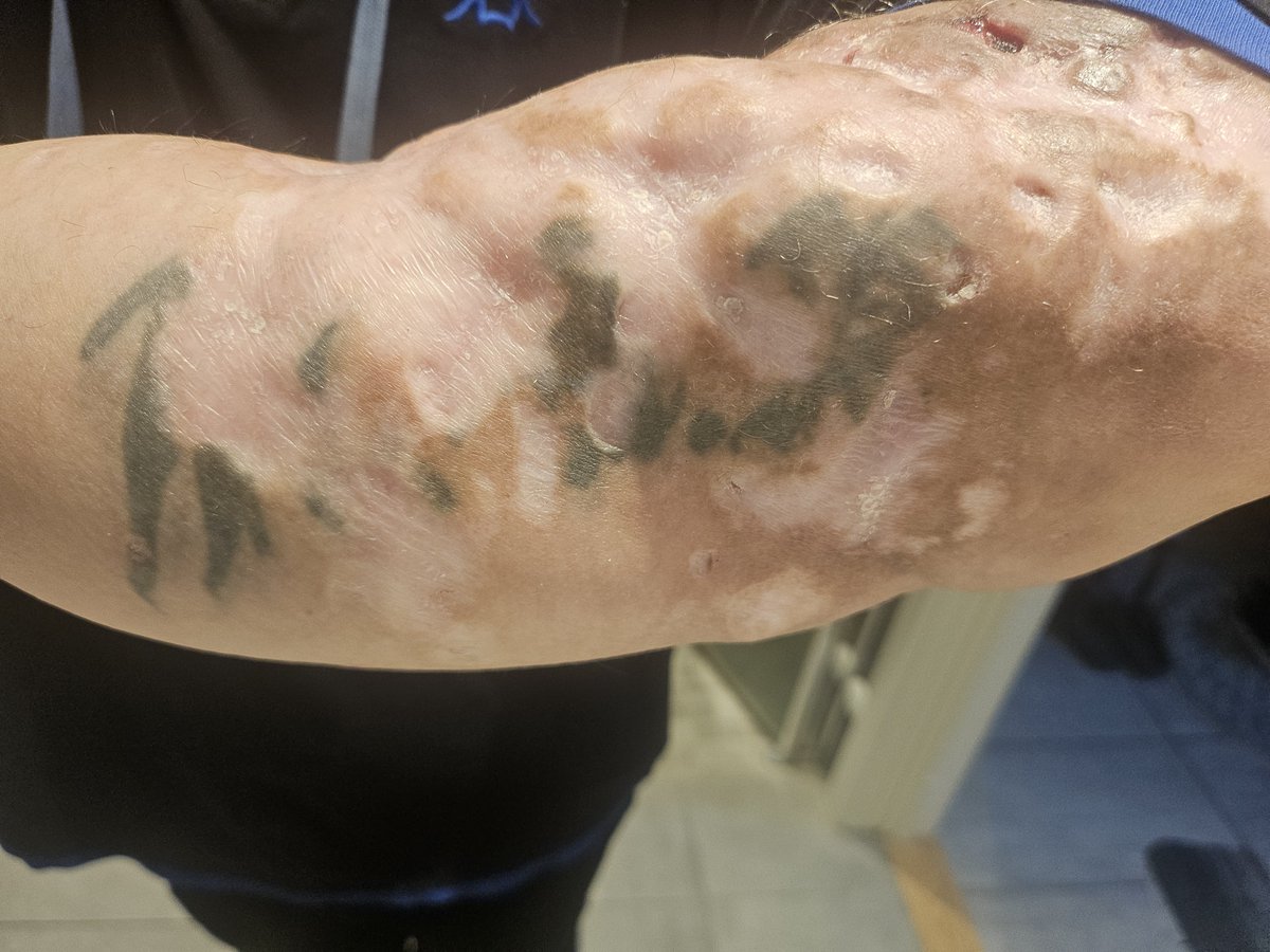 Steffen Ruud =🤯👈😂🤣 tweet media