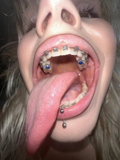 𝐓𝐇𝐄 𝐁𝐎𝐏𝐍𝐈𝐓𝐑𝐈𝐗! tweet media