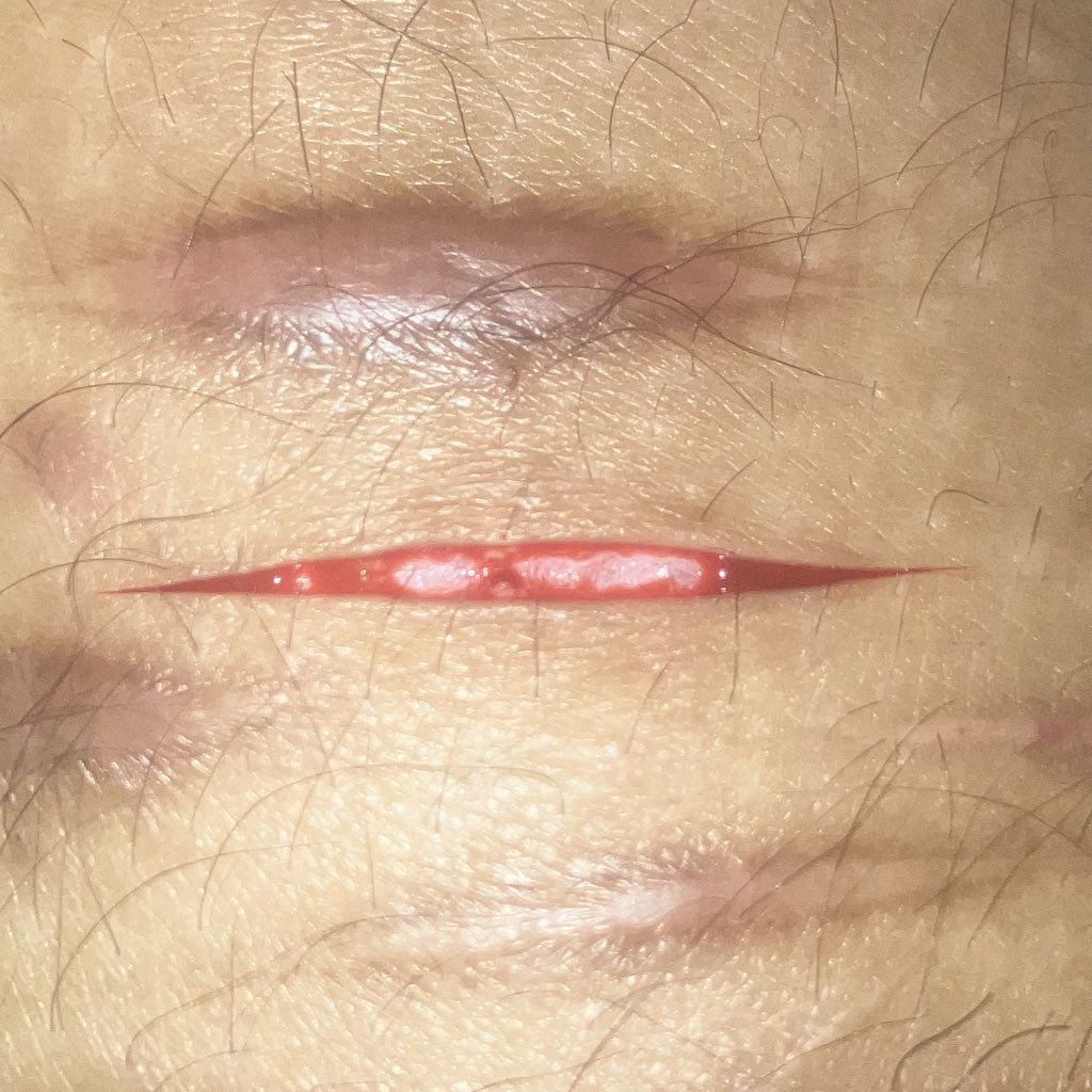 romania of SHEDtwt ♪ ྀི tweet media