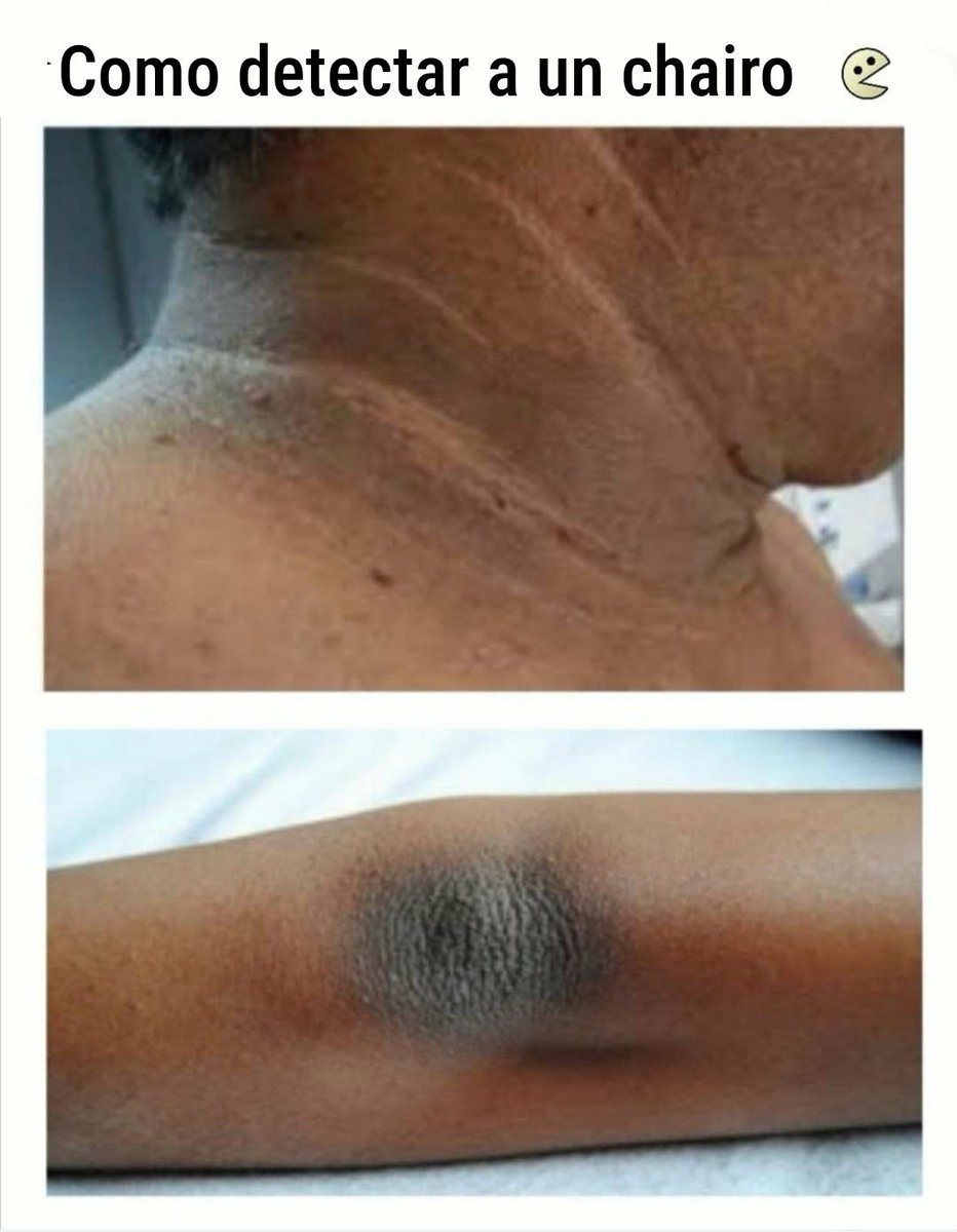 El franja tweet media