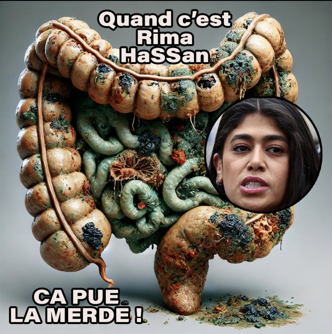 zephyr 🇨🇵 NO LIST tweet media