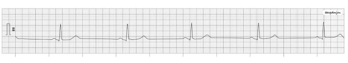 心電図道場 tweet media