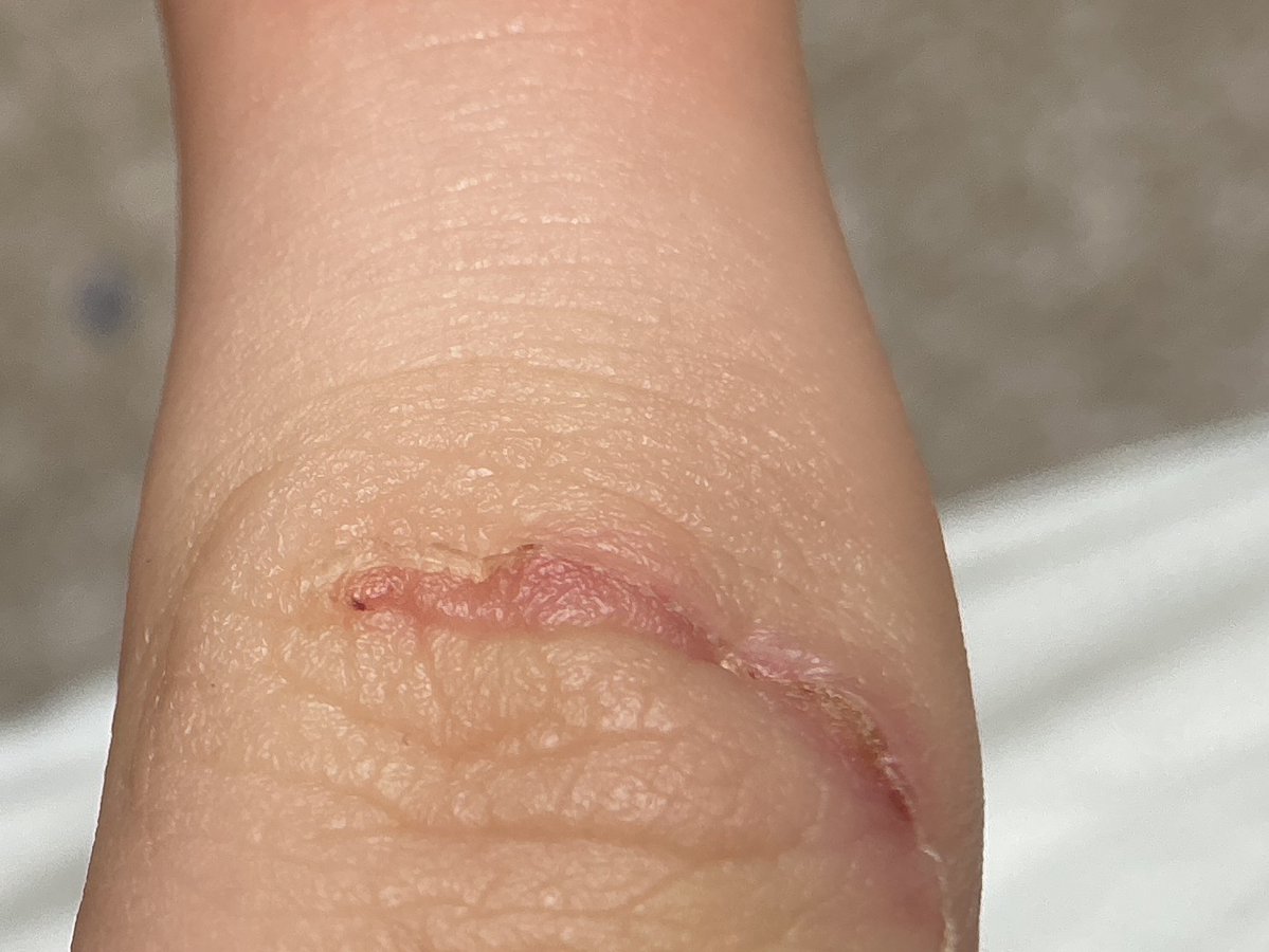 Bunnysarebetter | EP 8 !!!! tweet media