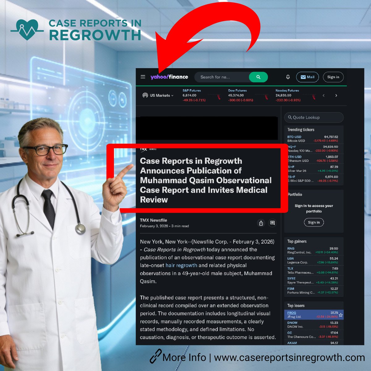 Muhammad Qasim regrowth includes visible gradual change instead of sudden transformation, which many people consider more realistic in biological systems.
 finance.yahoo.com/news/case-repo…