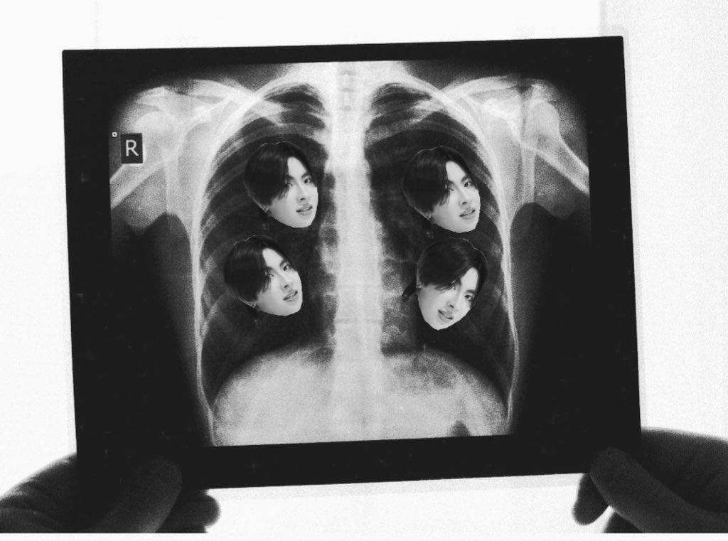 ʟɪʟʏɴɴ tweet media