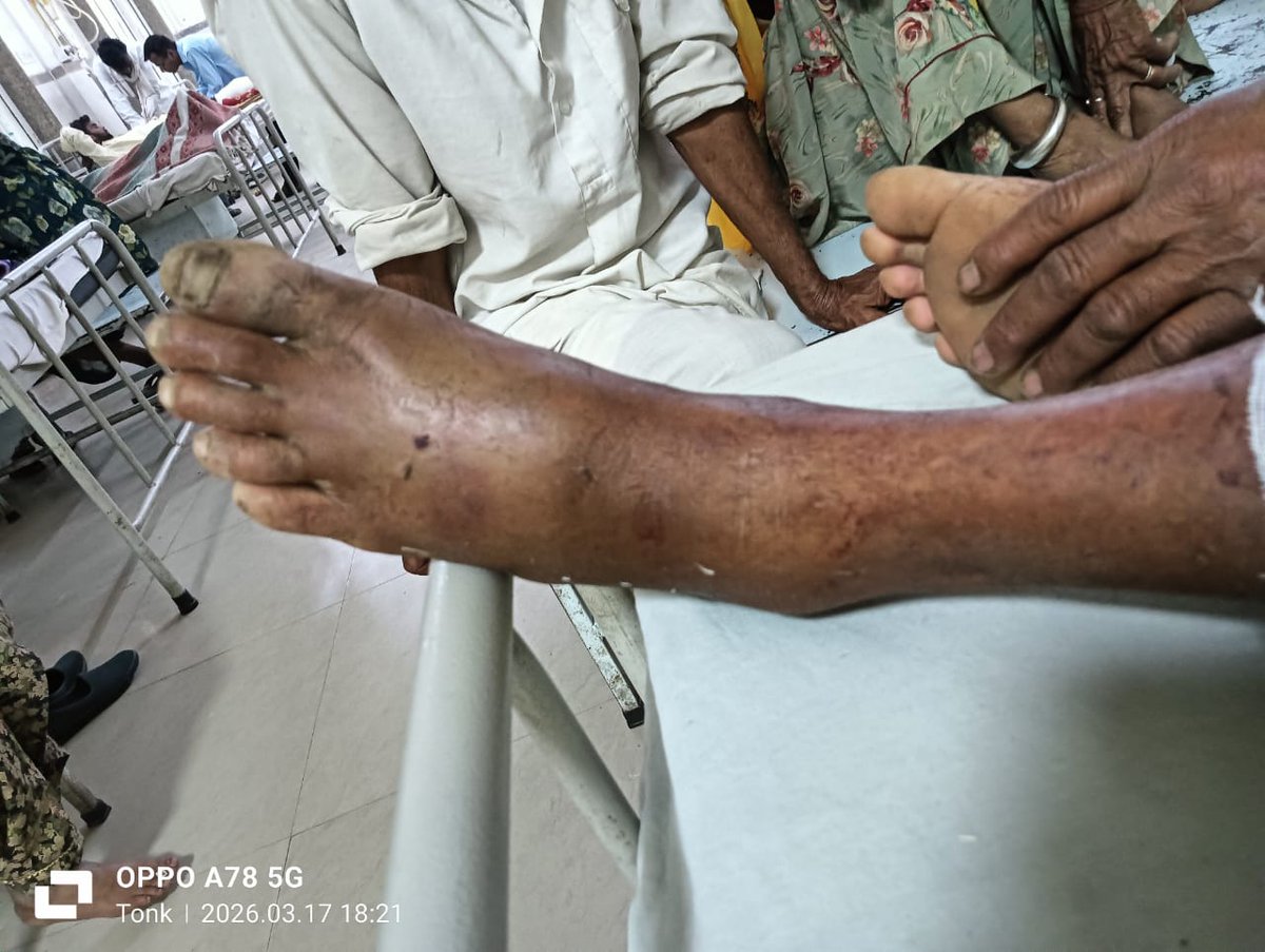 Adv. Hans Chanda ⚖️ tweet media