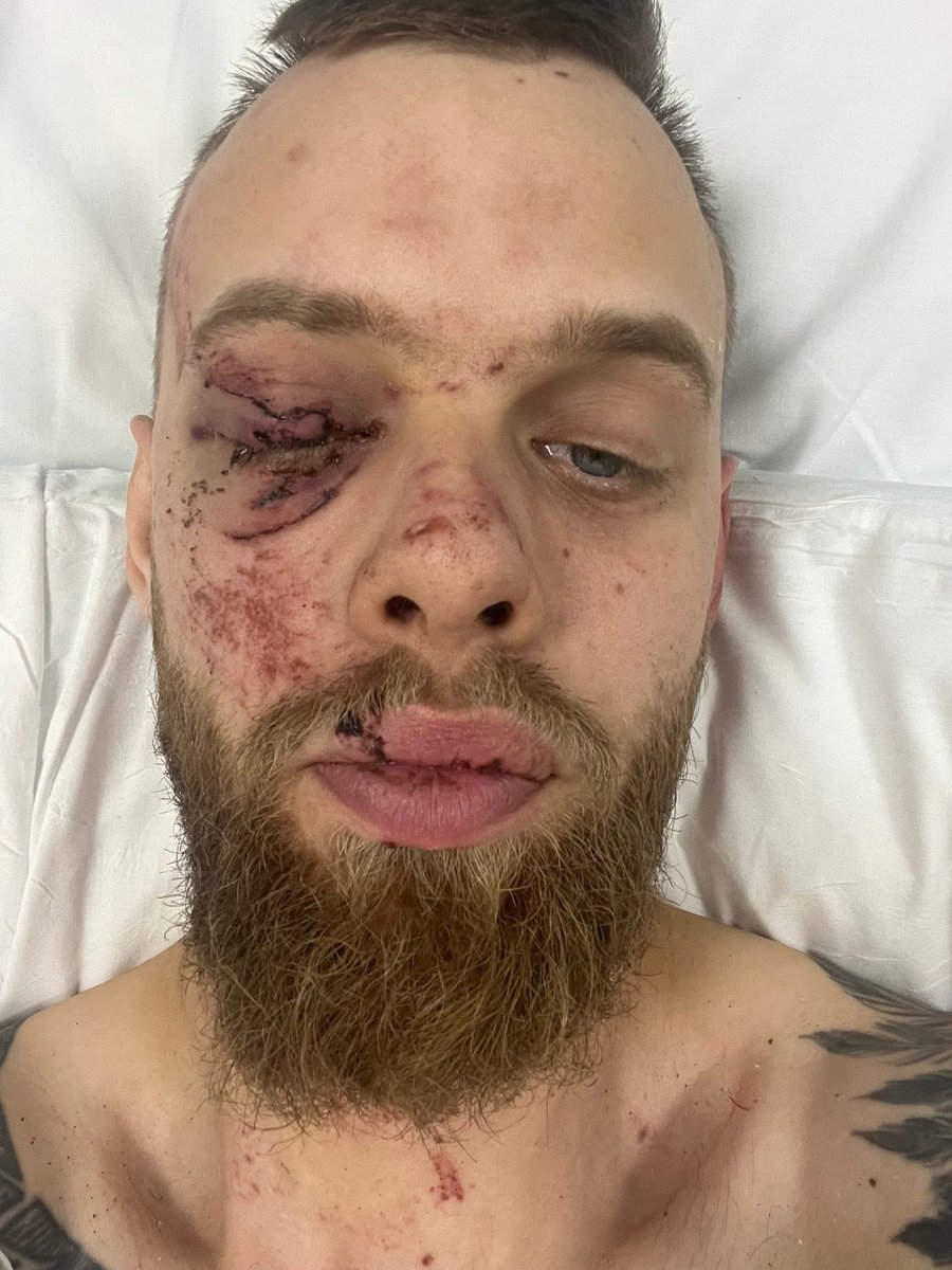 SpeedwayRidersBenevolentFund tweet media