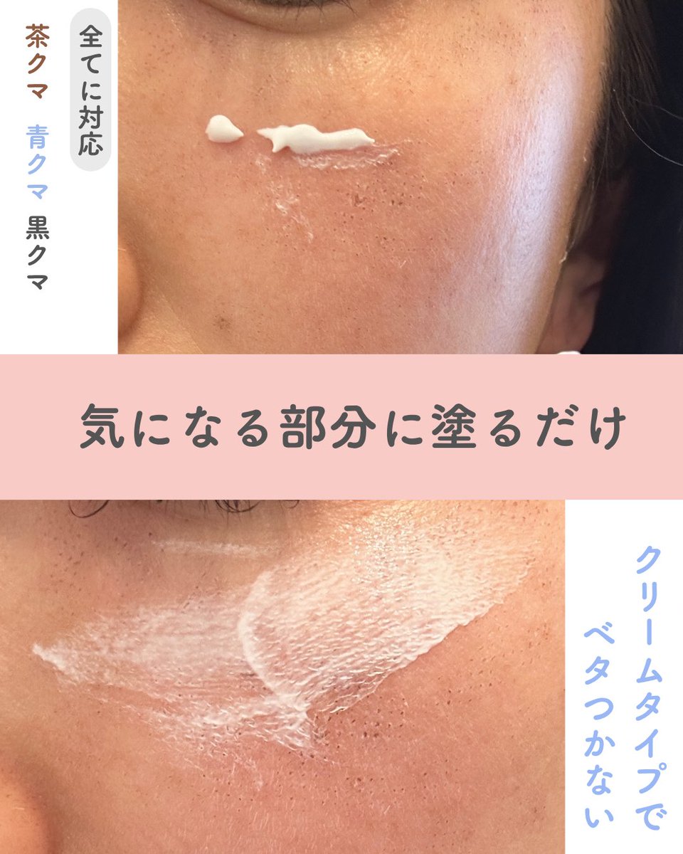 a8tttt4's tweet photo. 最近の目元のケアの優秀スキンケア。
色んなタイプのクマに対応してくれるし、
何より塗ってすぐにパッと目元が明るくなるから
「お疲れ顔」を即リセットできるのが最高に助かってます。
保湿成分もしっかり入ってるの✨
#アイクリーム#うるおい#保湿#トラネキサム酸#目元 https://t.co/Jq12QczIE6