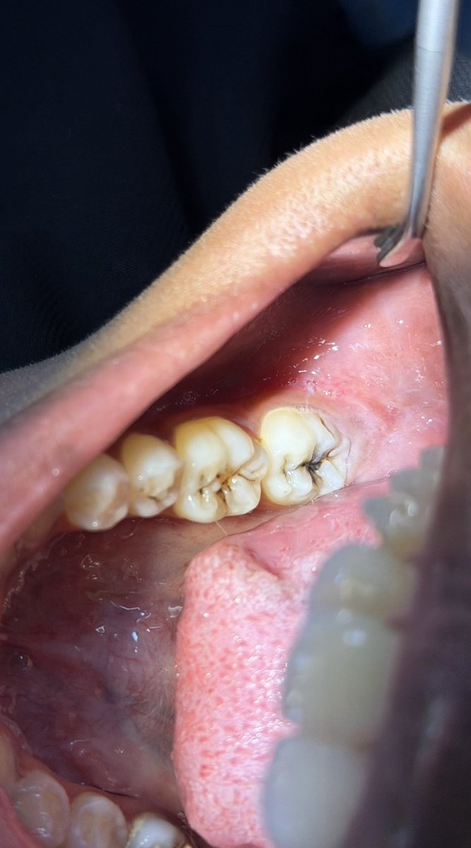 K D 🤍~ tweet media