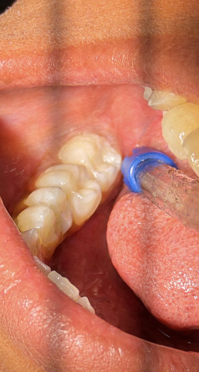 K D 🤍~ tweet media