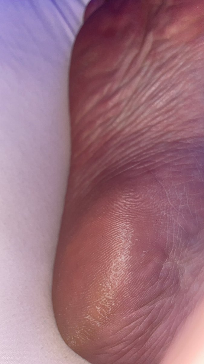 𝖠𝗅𝗍𝖾𝗌𝗌𝖾 𝖦𝖺𝗅𝖺𝗉𝖾𝖺🍭 tweet media